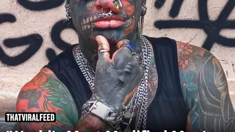 ‘World’s Most Modified Man’ Explains Why He Surgically Split His Hand In Half