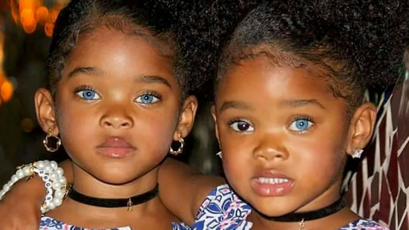 Trueblue Twins Megan and Morgan Are Growing Up — How They Are Doing Now